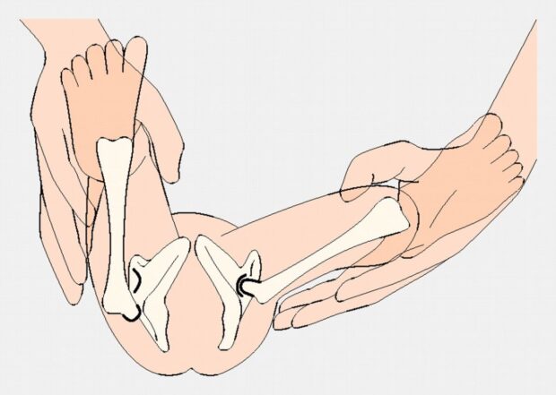 History of the Ortolani Test History of the Ortolani Test