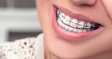 How Massage Therapy Can Enhance Your Mood and Emotional Wellbeing 5 Ways Braces Help To Improve Dental Health